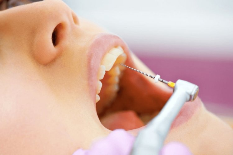 Past the Myths: Revealing the Advantages of Root Canal Therapy